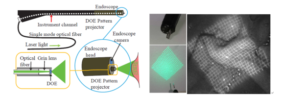 3次元内視鏡システム構成、超小型パターン光源外観、生体組織への投影画像例