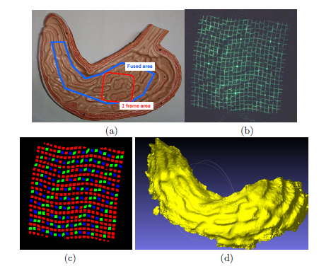 An example of measuring a phantom model of a stomach